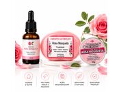 Kit Tratamento Completo Rosa Mosqueta: Clareia Manchas, Regenere a Pele e Suavize Marcas e Estrias